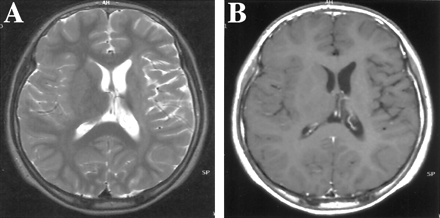 Fig 1.