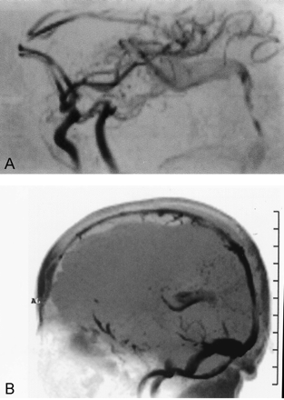 Fig 4.