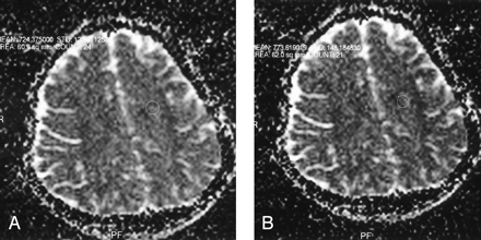 Fig 1.