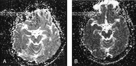Fig 3.