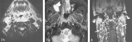 Fig 8.