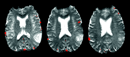 Fig 2.