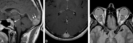 Fig 1.