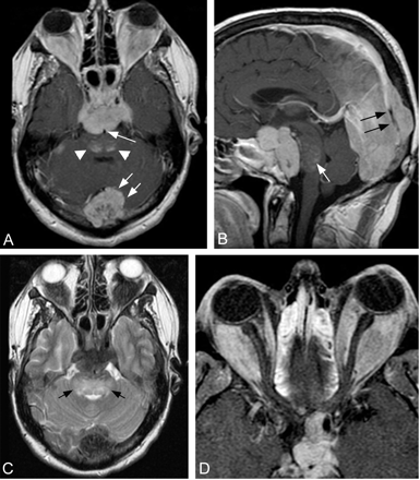 Fig 2.