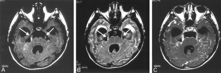 Fig 2.