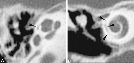 Fig 1.