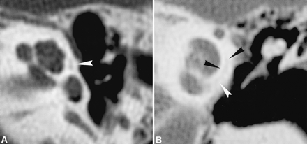 Fig 3.