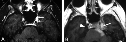 Fig 3.