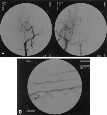 Fig 6.