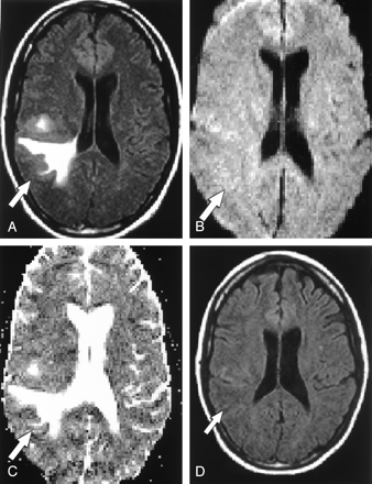 Fig 3.