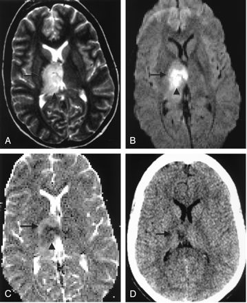 Fig 4.