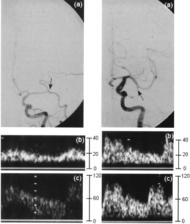 Fig 1.