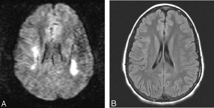 Fig 1.
