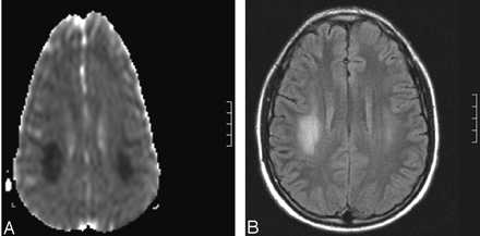 Fig 2.