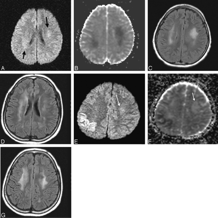 Fig 3.