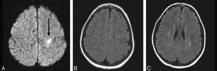 Fig 5.