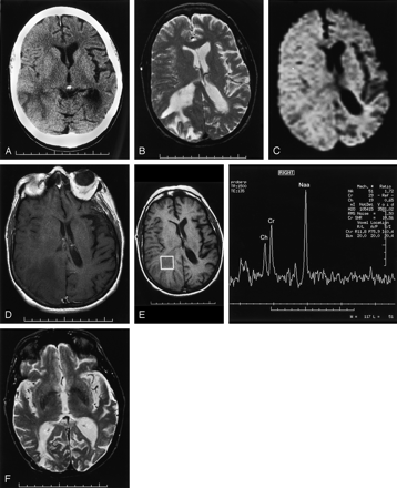 Fig 2.