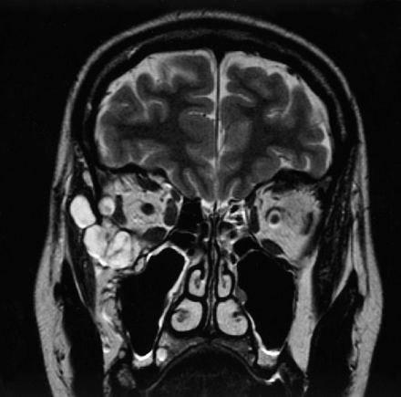 Fig 1.