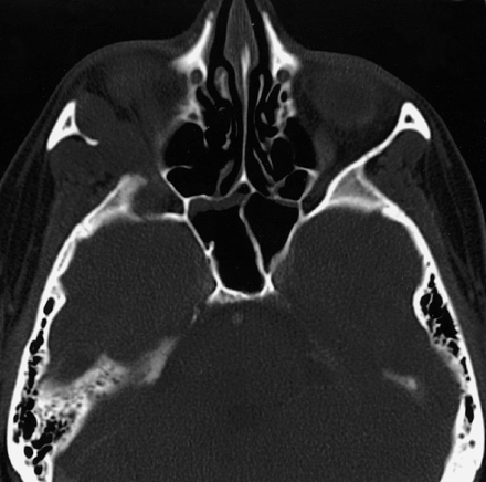 Fig 2.