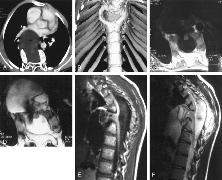 Fig 2.