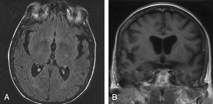 Fig 6.
