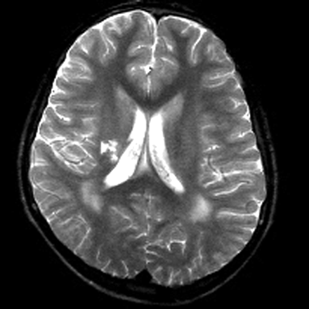 Fig 1.