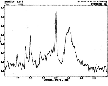 Fig 3.