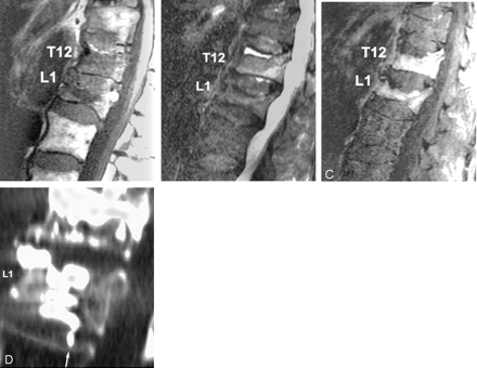 Fig 2.