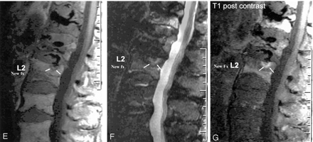 Fig 2.