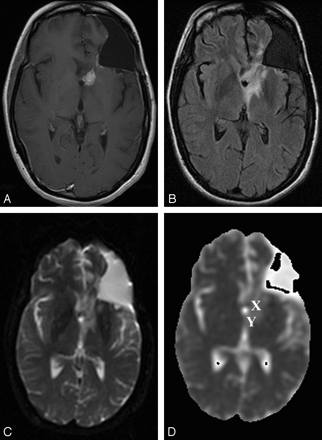 Fig 1.