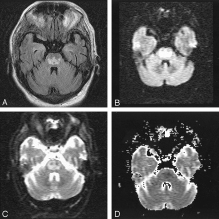 Fig 3.