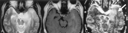 Fig 5.