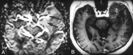 Fig 6.