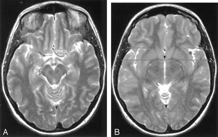Fig 9.
