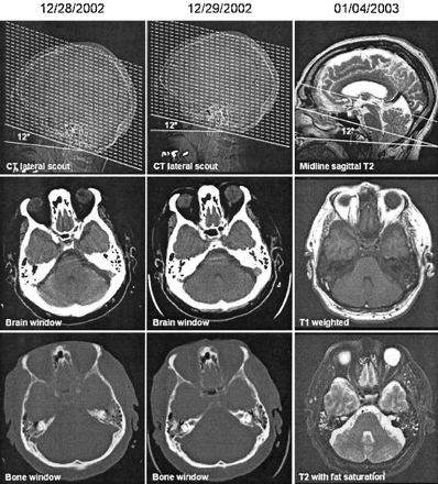 Fig 3.