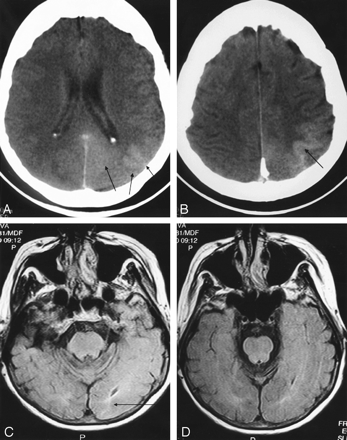 Fig 2.
