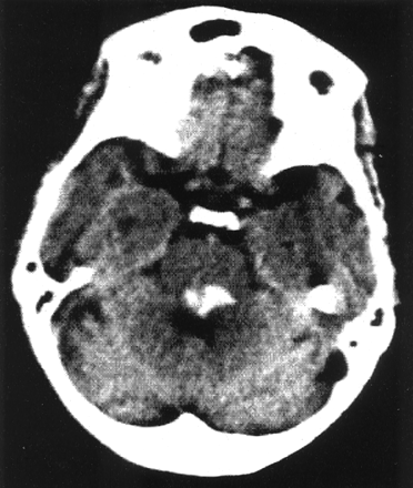 Fig 1.