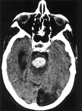 Fig 2.