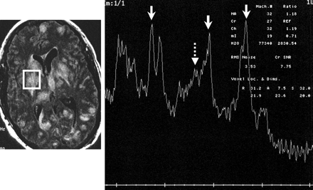 Fig 2.