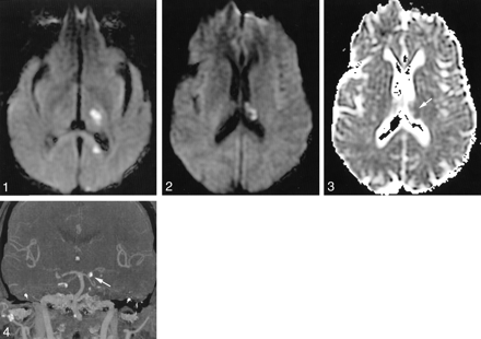 Fig 4.