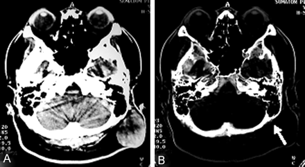 Fig 2.