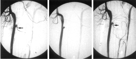 Fig 2.