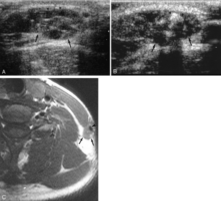 Fig 2.