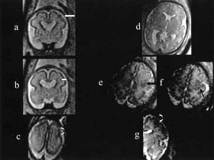Fig 1.