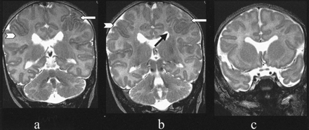 Fig 2.