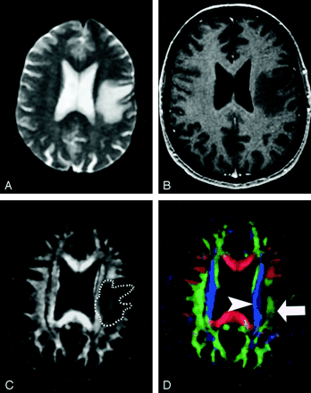 Fig 20.