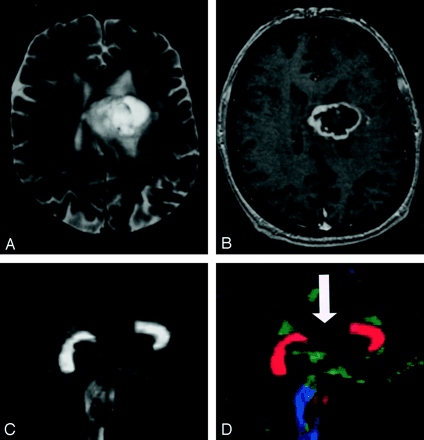 Fig 22.
