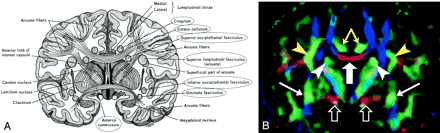 Fig 3.