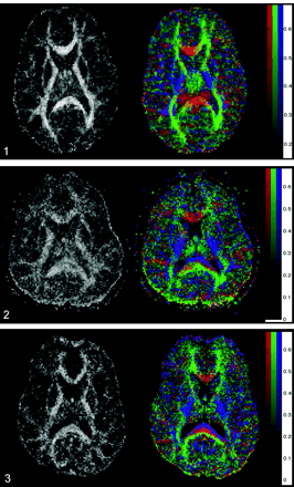 Fig 2.