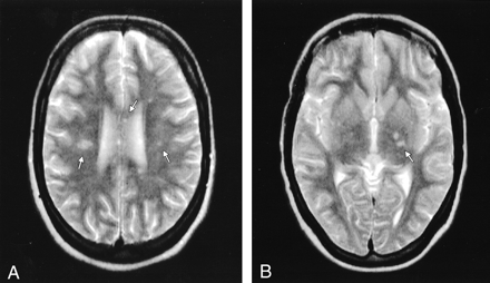 Fig 1.